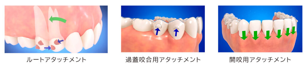 アタッチメント