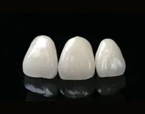 セラミックの歯