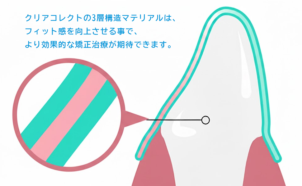 クリアコレクトの3層構造