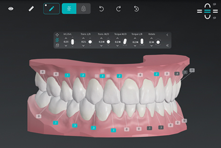 クリアパイロットの3Dシミュレーション画面のイメージ画像