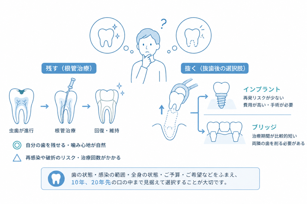 根管治療と抜歯のメリット・デメリットを比較したイラスト